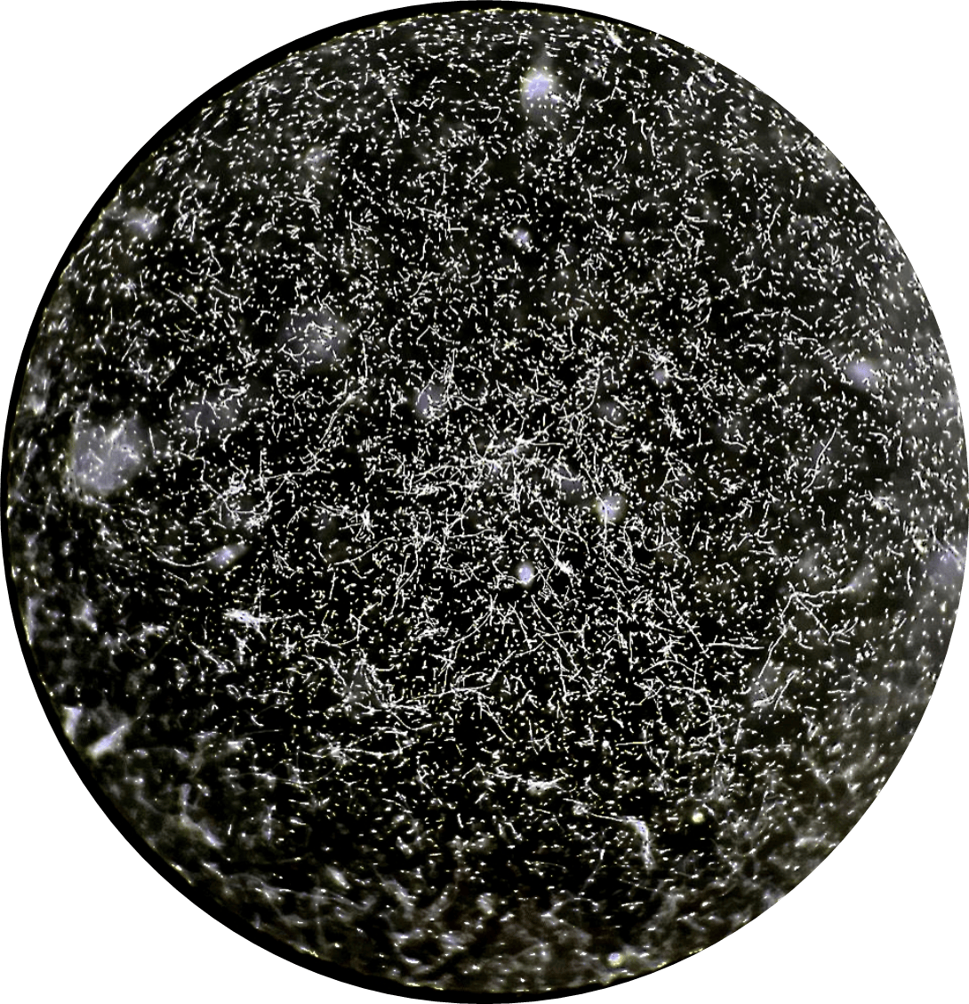 Лептоспиры в темном поле